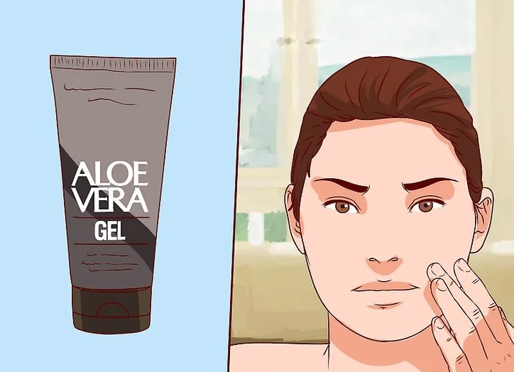 Pure Aloe Vera Gel For Acne